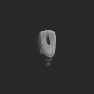 dentinova-custom-abutments-3d-dental-designs