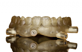 Surgical-Guide-Dentinova