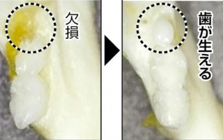 A Breakthrough in Teeth Regeneration: First Human Trials Begin This Month