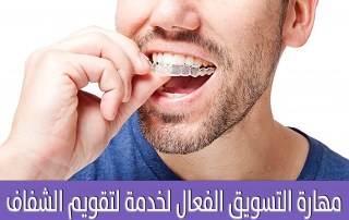 مهارة التسويق الفعال لخدمة لتقويم الشفاف - Dentinova